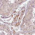 Anti-PRR16 Antibody