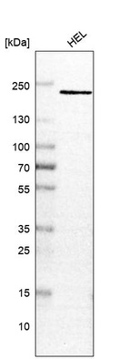 Anti-PSME4 Antibody