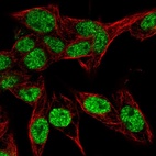 Immunofluorescent staining of human cell line Hep G2 shows localization to nucleoplasm.