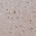 Anti-ZBTB48 Antibody