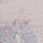 Anti-ZBTB48 Antibody