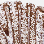 Anti-SMOX Antibody