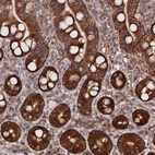 Anti-DHX29 Antibody