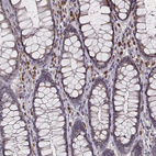 Anti-P2RX5 Antibody