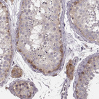 Anti-P2RX5 Antibody