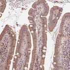 Anti-CUTA Antibody