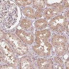 Anti-CUTA Antibody