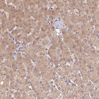 Anti-CUTA Antibody