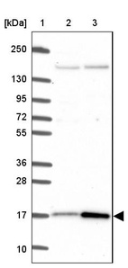 Anti-CUTA Antibody