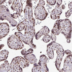 Immunohistochemical staining of human placenta shows moderate nuclear positivity in trophoblastic cells.