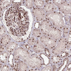 Immunohistochemical staining of human kidney shows moderate nuclear positivity in cells in glomeruli and cells in tubules.