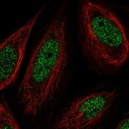 Immunofluorescent staining of human cell line SiHa shows localization to nucleoplasm.