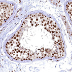 Anti-RSRC2 Antibody