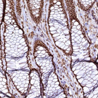 Anti-RSRC2 Antibody