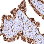 Anti-RSRC2 Antibody