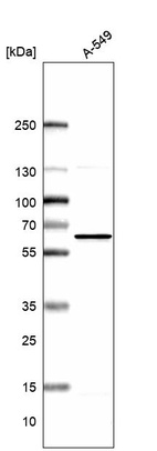 Anti-NMT1 Antibody