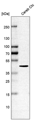 Anti-ITPKA Antibody