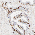 Anti-KRT15 Antibody