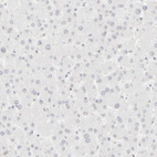 Anti-KRT15 Antibody