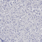 Anti-AGRP Antibody