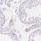 Anti-HCRTR2 Antibody