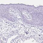 Anti-HCRTR2 Antibody