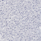 Anti-PURG Antibody