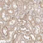 Anti-B3GNTL1 Antibody