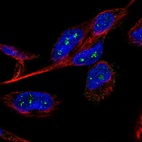 Anti-B3GNTL1 Antibody