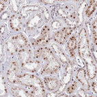 Anti-MFSD12 Antibody