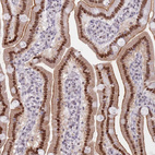 Anti-MFSD12 Antibody