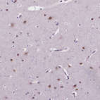 Immunohistochemical staining of human cerebral cortex shows moderate nuclear/cytoplasmic nuclear/ nucleoli positivity in neurons.