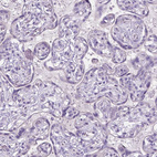 Immunohistochemical staining of human placenta shows no positivity in trophoblastic cells as expected.