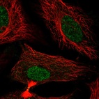 Immunofluorescent staining of human cell line HeLa shows localization to nucleoplasm & cytokinetic bridge.