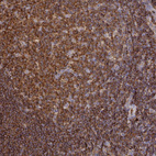 Anti-CFL1 Antibody