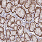 Anti-CFL1 Antibody