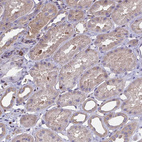 Anti-CFL1 Antibody