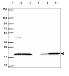 Anti-CFL1 Antibody