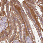 Anti-GSTA1 Antibody