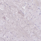 Anti-GSTA1 Antibody