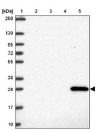 Anti-GSTA1 Antibody