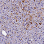 Anti-KDELR3 Antibody