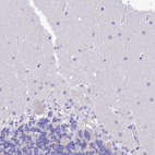 Anti-KDELR3 Antibody