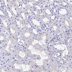 Anti-KDELR3 Antibody