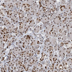 Anti-HEMK1 Antibody