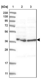 Anti-HEMK1 Antibody