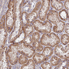 Anti-ADGRF3 Antibody