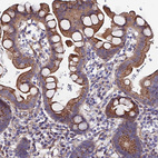 Anti-ADGRF3 Antibody