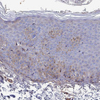 Anti-ADGRF3 Antibody