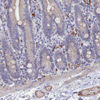 Anti-ARAP3 Antibody